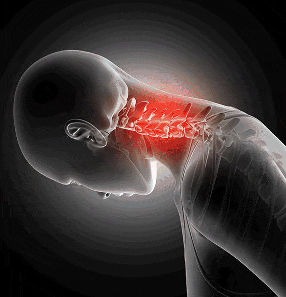 almohada cervical, almohada ergonómica cervical, almohada viscoelástica cervical, mejor almohada cervical dolor de cuello, almohada contorno cervical espalda lateral
